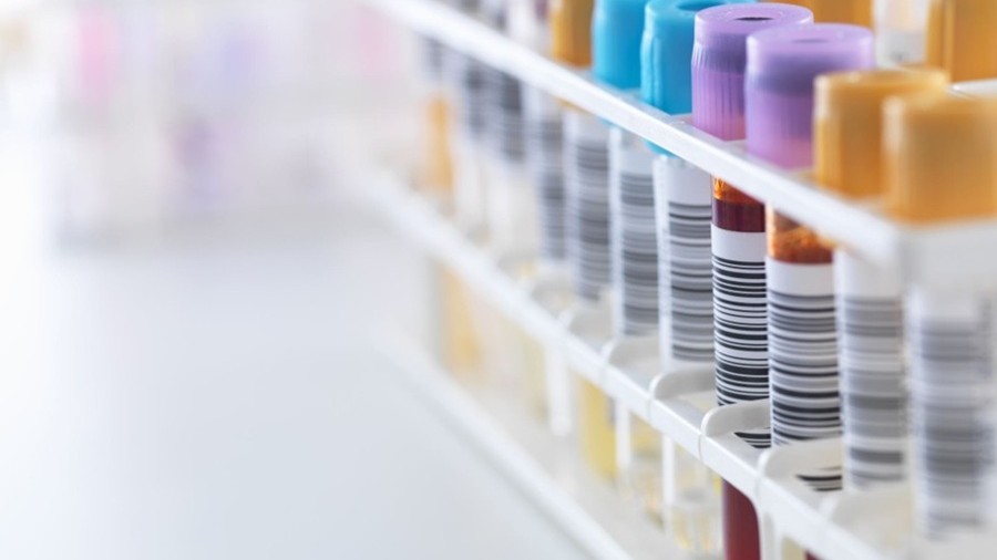 Billions set aside, but who is entitled to claim? Understanding the Infected Blood Compensation Scheme